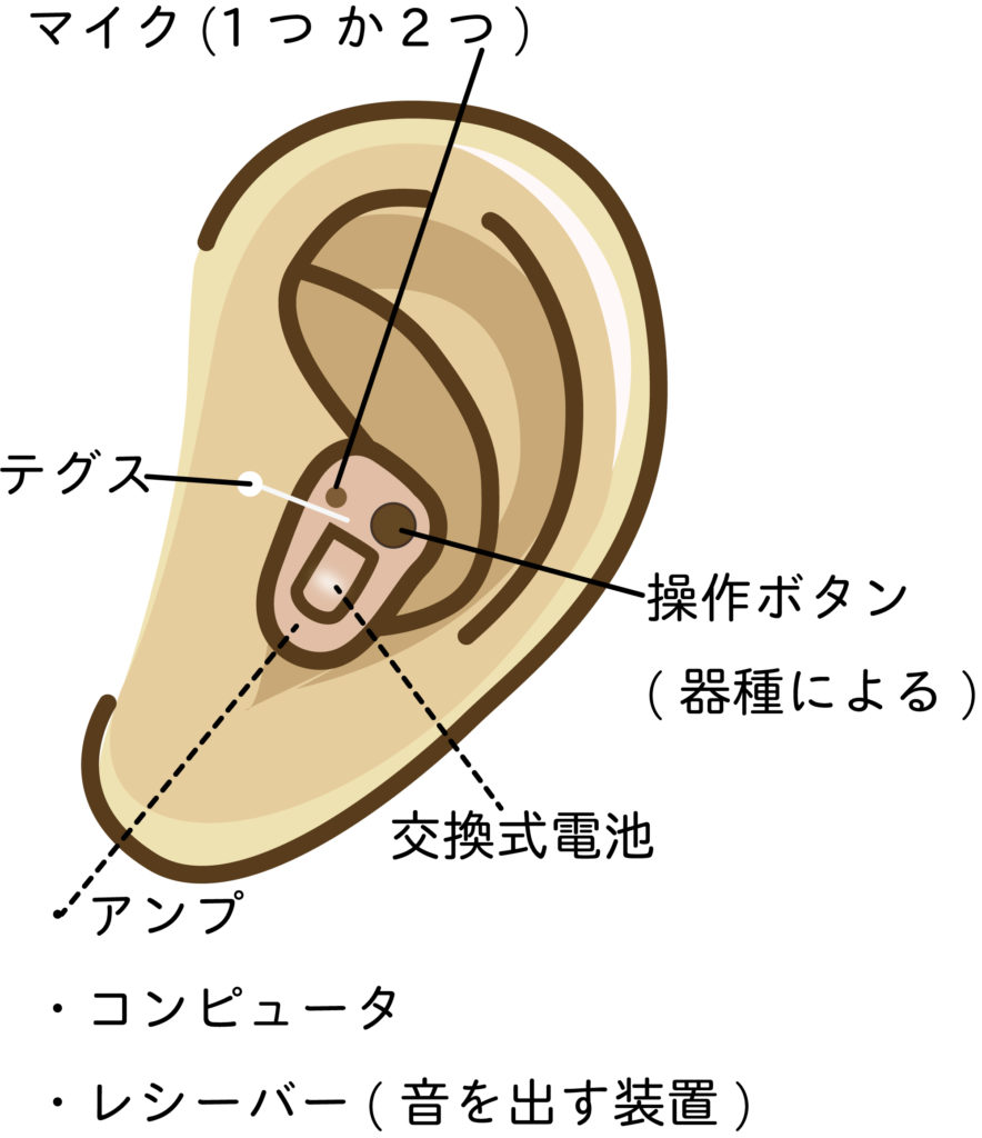 補聴器の種類と特徴 公式 あそう補聴器 麻生補聴器ホールディングス株式会社