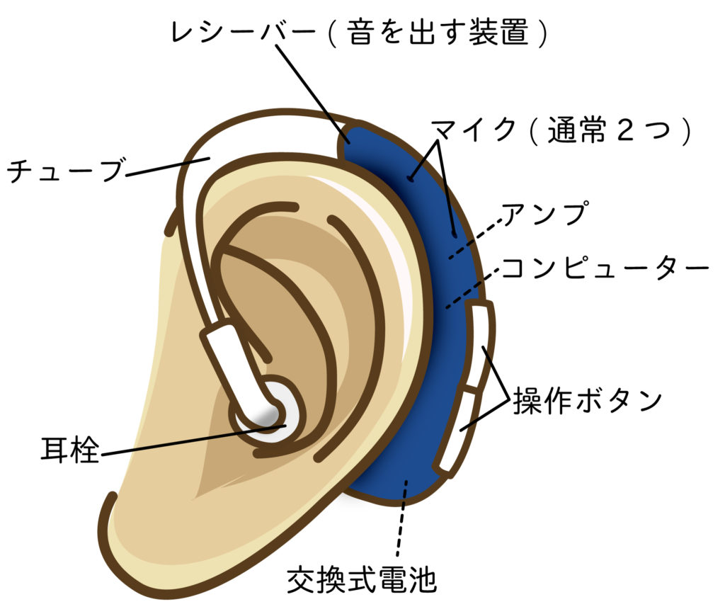 補聴器の種類と特徴 公式 あそう補聴器 麻生補聴器ホールディングス株式会社