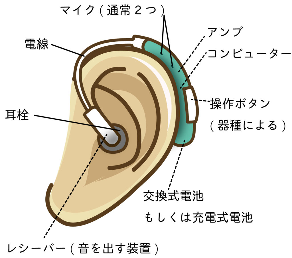 補聴器の種類と特徴 公式 あそう補聴器